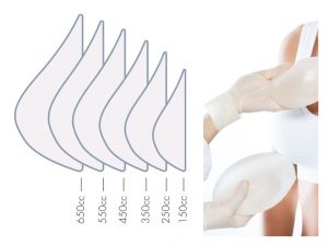 diagrama de tamaños de implantes mamarios y mujer eligiendo tamaño de unos implantes